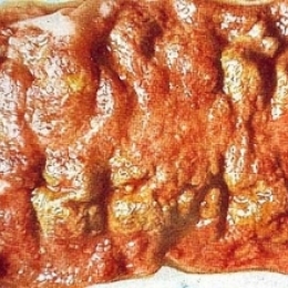 К чему приводит забор воды из непроверенных источников?