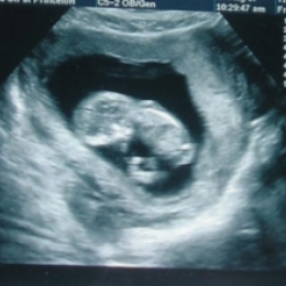 Как использовать данные УЗИ при беременности?