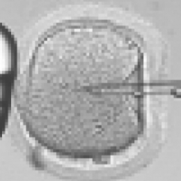 Какое существует эффективное лечение бесплодия?