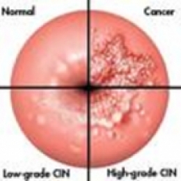 О чём говорят боли и кровянистые выделения после полового акта?