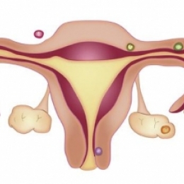 Боли внизу живота и кровотечение в начале беременности, что это может быть?