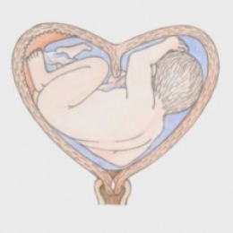 Как влияет врождённая деформация матки на беременность и роды?