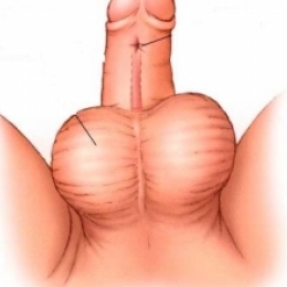 Почему мальчик не может писать стоя?