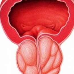 Увеличенная простата. Что может за этим скрываться?