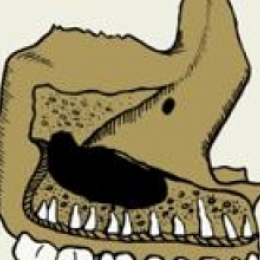 Чем грозит не леченый насморк?