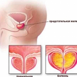 С чем может быть связано учащённое ночное мочеиспускание?