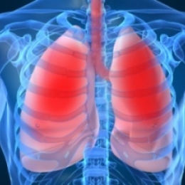 Сильная одышка и розовая пенистая мокрота - срочно 03!