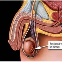Яичко опухло, тяжесть и дискомфорт в мошонке, что это может быть?