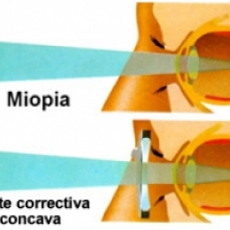 Не вижу вдали