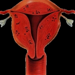 Чем опасно повышение уровня эстрогенов в крови?