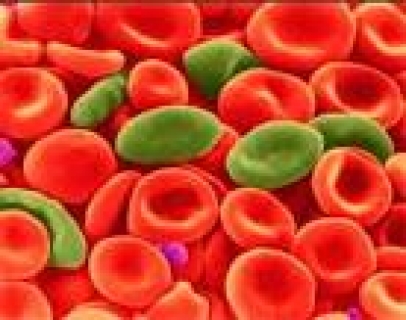 Анемия при хронических болезнях, классифицированных в других рубриках