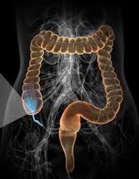 Брюшной тиф