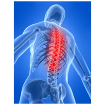 Нейросифилис