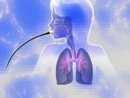 Бронхолёгочный аспергиллёз