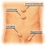 Абдоминальная грыжа