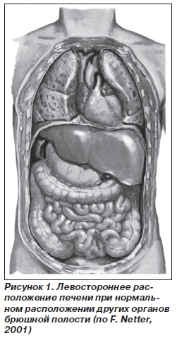 Аномалии развития печени у детей