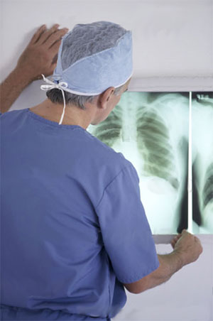 Ателектаз легких