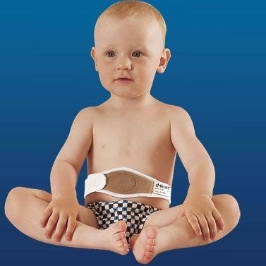 Грыжа белой линии живота у детей