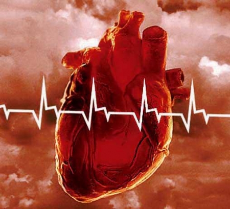 Гипертрофическая кардиомиопатия