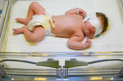 Аспирации мекония фото