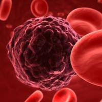 Гемомеланоз