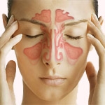 Отёк Квинке