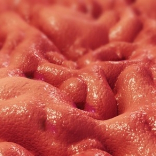 Алкогольный гастрит