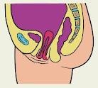 Аномалии положения женских половых органов
