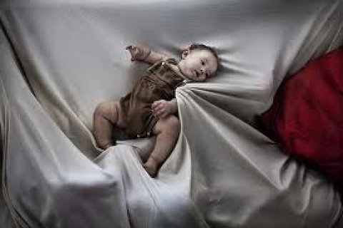 Адреногенитальный синдром