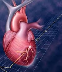 Внезапная сердечная смерть (ВСС)