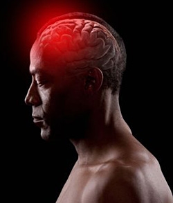 Внутримозговое кровоизлияние