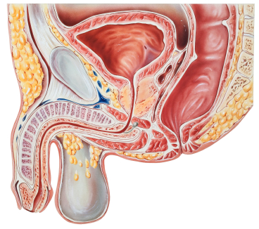 Орхит (яичка инфекции) фото