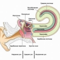 Острый неврит слуховых нервов