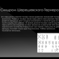 Синдром Тёрнера
