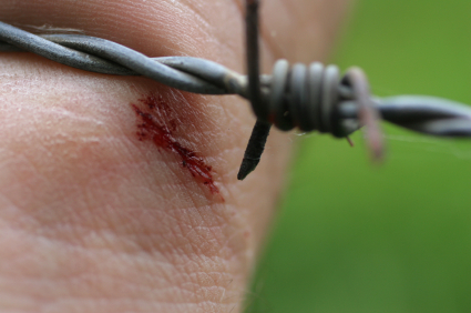 Столбняк фото