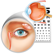 Глазные болезни