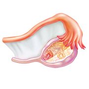 Женское здоровье