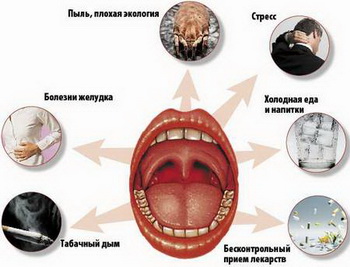 возможные причины боли в горле