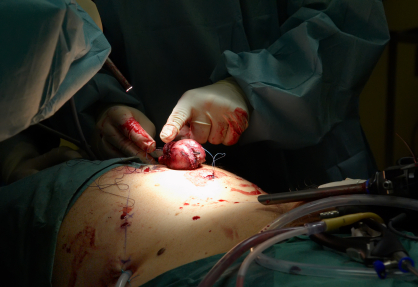 Хирургия фото