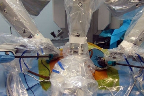 Первая операция, выполненная роботом без вмешательства человека