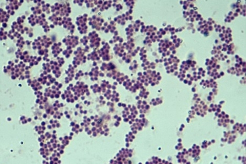 Смертельно опасный штамм менингококковой инфекции