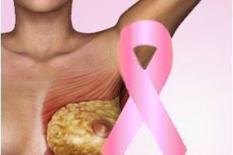 Генетический анализ - ранний маркер рака молочной железы