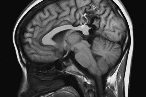 Наночастицы изменят МРТ-диагностику