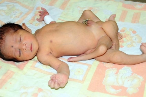 Родился шестиногим