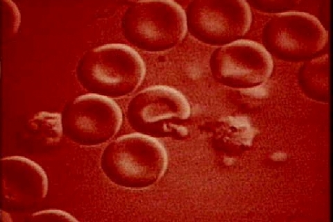 Вакцина, представляющая угрозу для жизни