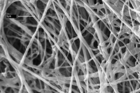 Нанолечение в лечении инфаркта миокарда