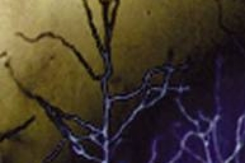 Соединение, препятствующее востановлению мозга после инсульта