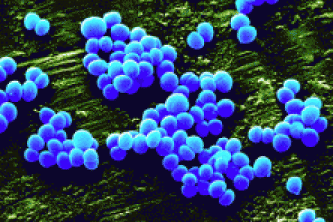 За госпитальную инфекцию больница заплатит 1,5 миллиона долларов США