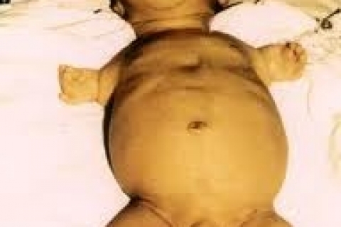 51 год забвения, или история роковой ошибки науки