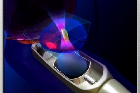 Неинвазивное лечение рака предстательной железы